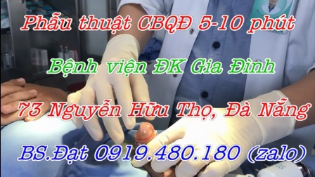 cắt bao quy đầu